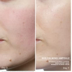 Babor SOS Calming Ampoule Concentrates -Verzorgingsproducten Winkel 1072295 3