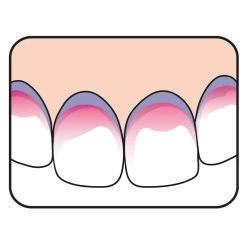 5x TePe PlaqSearch 7 5x TePe PlaqSearch -Verzorgingsproducten Winkel 945172 4